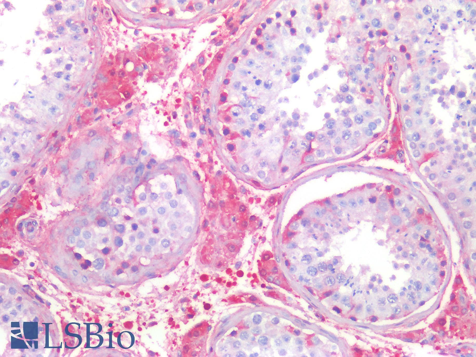 S100A6 / Calcyclin Antibody (aa1-89)