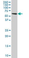 IHC-plus™ TROVE2 Antibody (clone 2B4)