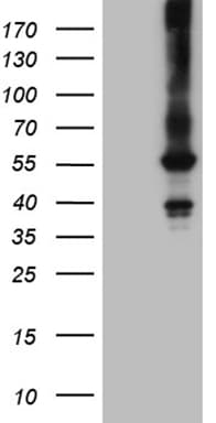 FCRLB / FREB-2 Antibody (aa202-426, clone OTI5H5)