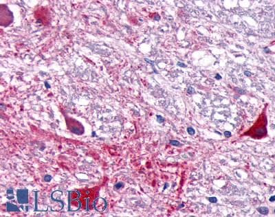 PathPlus™ Polyclonal Rabbit anti-Human RORA / ROR Alpha Antibody (Ligand-binding Domain, IHC)
