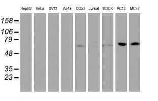 FBXO21 Antibody (clone OTI2B8)