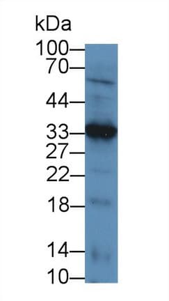 LECT1 / Chondromodulin-I Antibody (aa134-334)