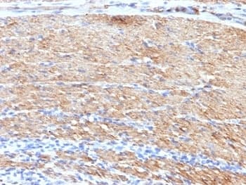 SMMHC / MYH11 Antibody (clone MYH11/923 + SMMS-1, Ready-to-Use)