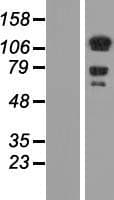 DAAM1 Protein (Over-Expression Lysate Myc-DDK (Flag))