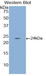 ESM1 / Endocan Antibody (aa20-184)