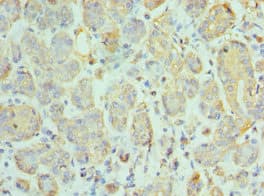 CCL28 / MEC Antibody (aa20-127)