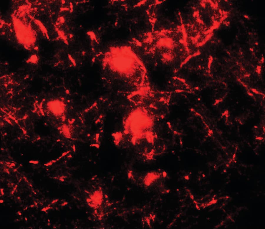 IHC-plus™ ULK2 Antibody
