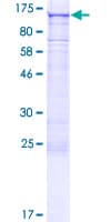 Human PARP8 Protein (Recombinant GST)