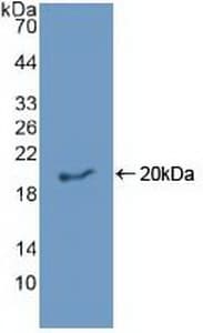 EREG / Epiregulin Antibody (aa30-169, PE)