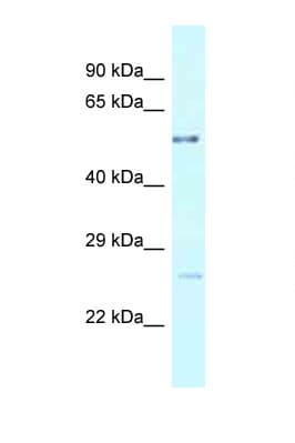 Polyclonal Rabbit anti-Human ENTPD3 Antibody (aa275-324, WB)