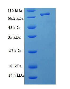 Human NOP58 / NOP5 Protein (Recombinant His-SUMO)
