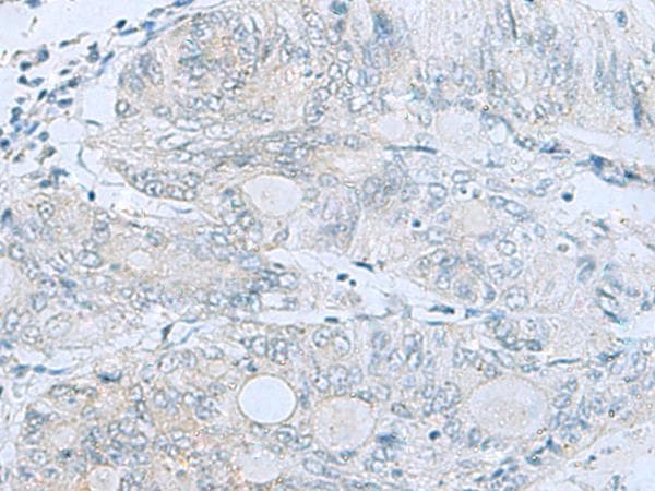 Polyclonal Rabbit anti-Human MGME1 / C20orf72 Antibody (IHC)