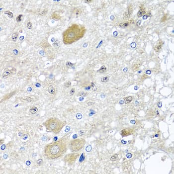 CST1 / Cystatin SN Antibody