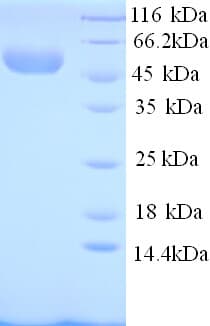 Rabbit SELE / CD62E / E-selectin Protein (Recombinant His)