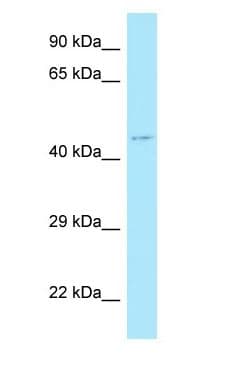 Polyclonal Rabbit anti-Human MLNR/GPR38/Motilin Receptor Antibody (C-Terminus, WB)