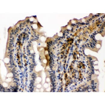 SMC3 / HCAP Antibody (aa1178-1216)