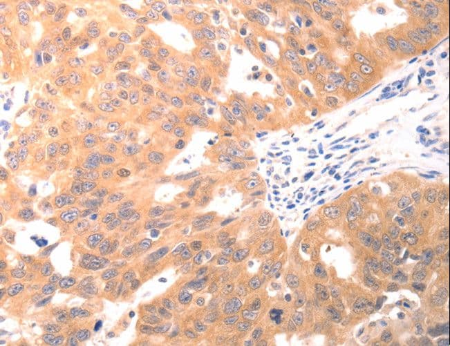 CAPNS1 / CAPN4 Antibody