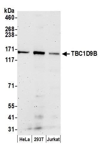TBC1D9B Antibody (aa1200-1250)
