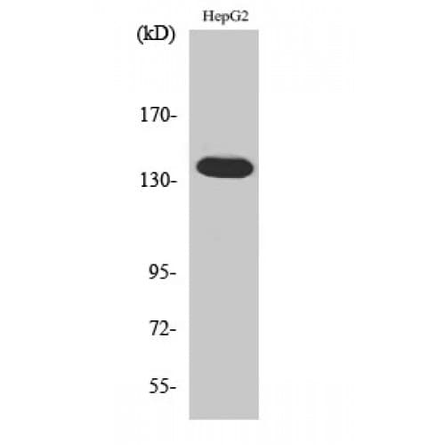 ATXN2 / SCA2 / Ataxin-2 Antibody (700-780 aa, Internal)