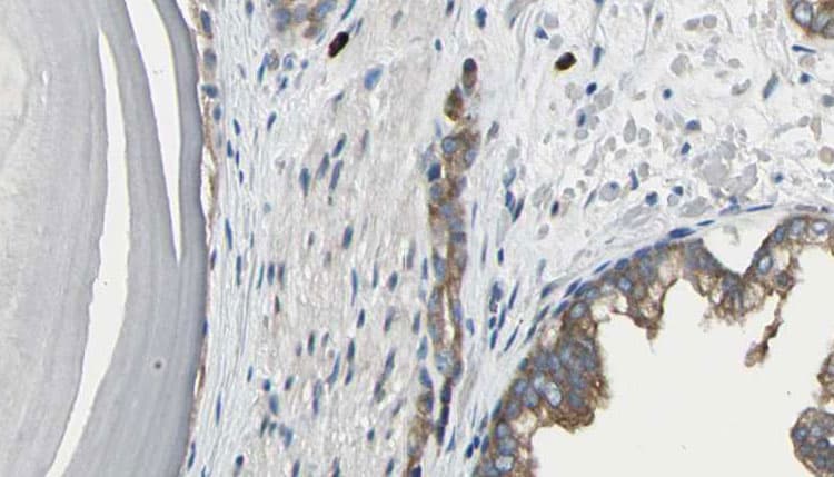 RAB5A / RAB5 Antibody