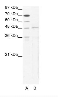 TBX5 Antibody (aa124-173)