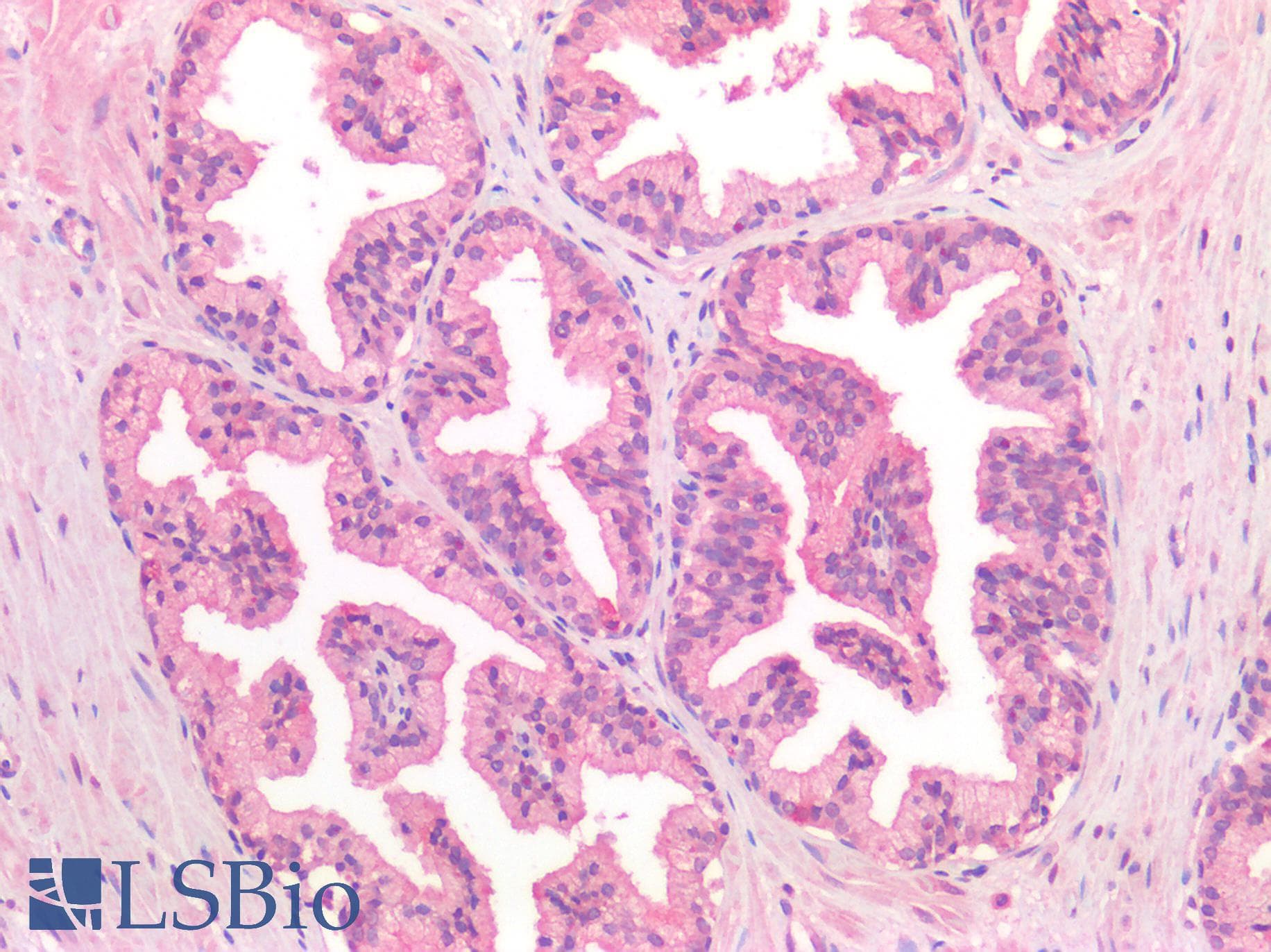 IHC-plus™ Polyclonal Rabbit anti-Human FOLH1 / PSMA Antibody (IHC)