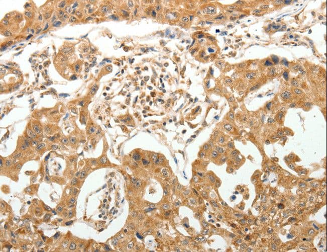 MAP1B Antibody