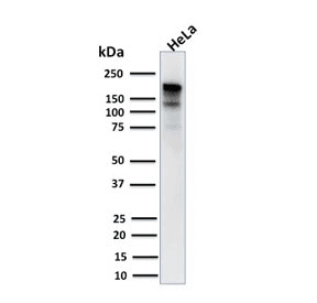 MSH6 Antibody (clone MSH6/3085)