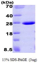 Human Aprataxin / APTX Protein (Recombinant His)