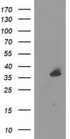 UNG / Uracil DNA Glycosylase Antibody (clone OTI1A11)