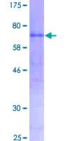 Human AMY2A / Pancreatic Amylase Protein (Recombinant GST)