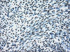 ERCC1 Antibody (clone OTI1A3)