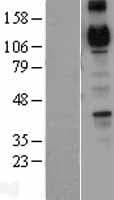 CDH4 / R Cadherin Protein (Over-Expression Lysate Myc-DDK (Flag))