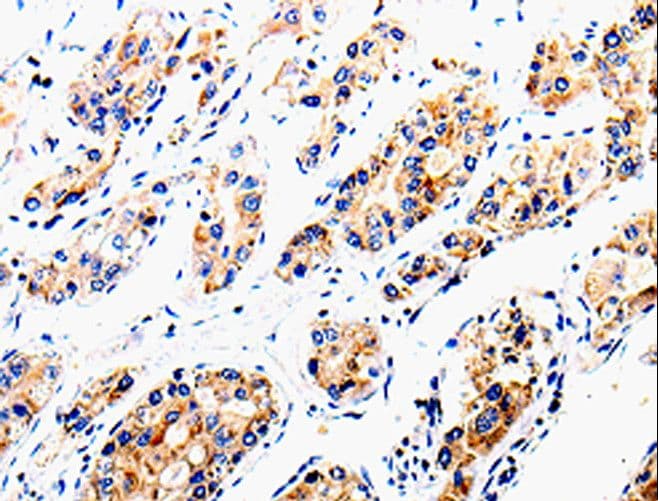 COX16 / C14orf112 Antibody