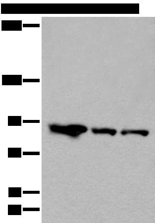 Polyclonal Rabbit anti-Human VPS35 Antibody (IHC, WB)