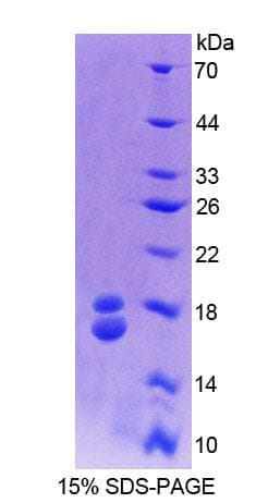 Bovine RBP1 / CRBP Protein (Recombinant His)