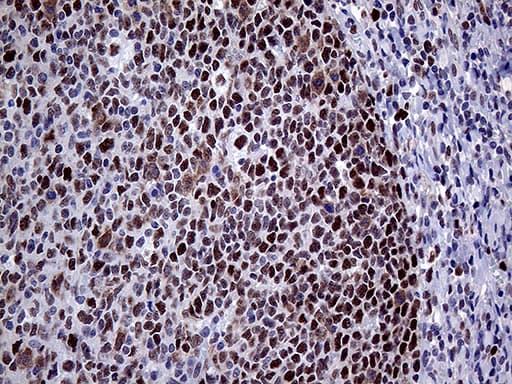 MLH1 Antibody (aa299-527, clone OTI3C1)