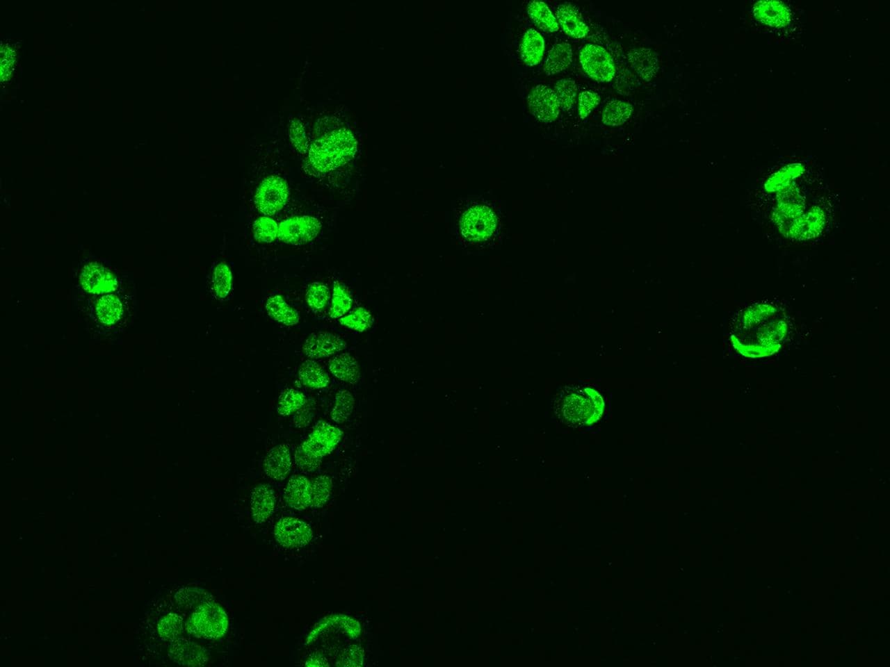 SAFB2 Antibody