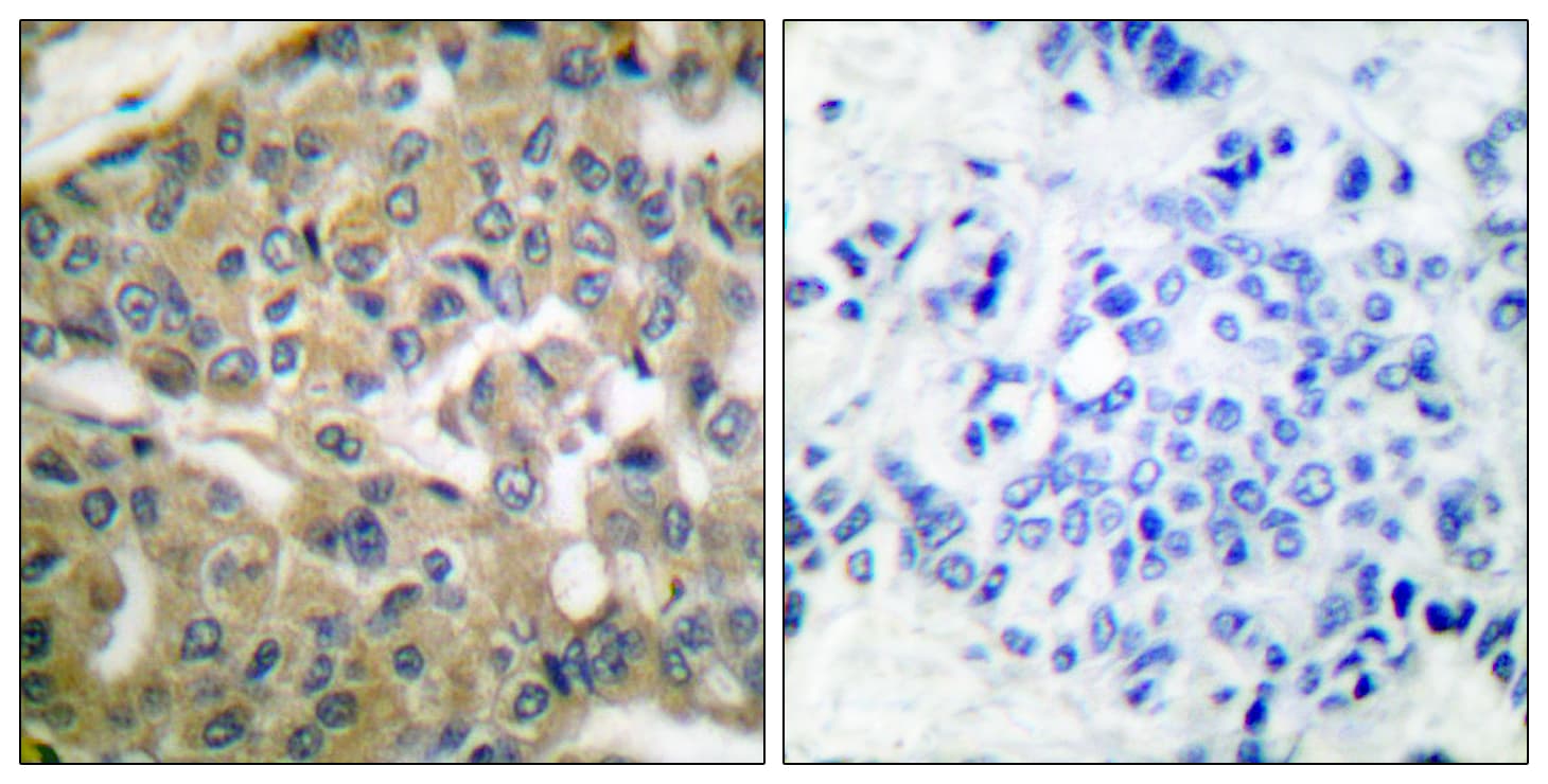 FHIT Antibody (aa81-130)