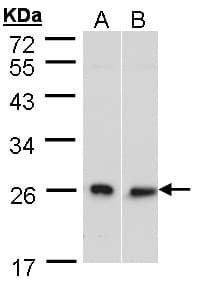 IHC-plus™ DNAJB6 Antibody (aa1-116)