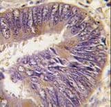 Polyclonal Rabbit anti-Human ST13 Antibody (aa50-80, IHC, WB)