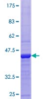 Human Cystatin SA / CST2 Protein (Recombinant GST)