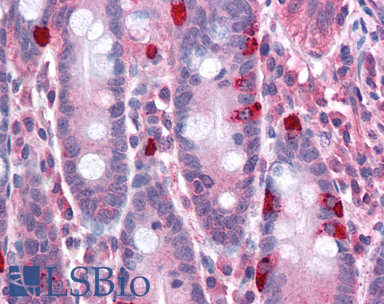 IHC-plus™ Polyclonal Rabbit anti-Human CADPS Antibody (IHC, IF, WB)