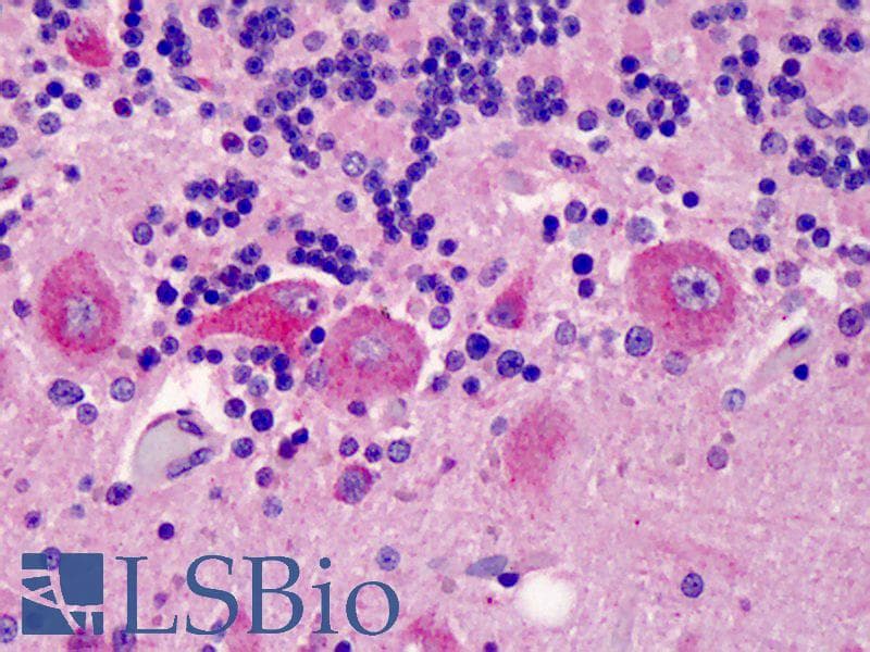 IHC-plus™ C5AR2 / GPR77 / C5L2 Antibody (aa1-50)
