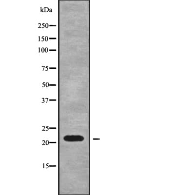 RPL18A Antibody