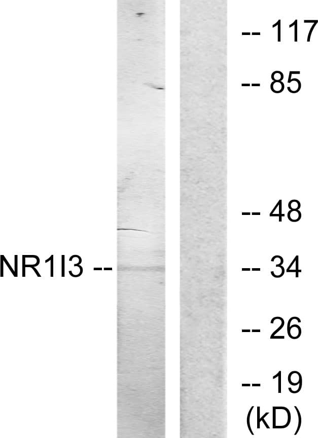 IHC-plus™ NR1I3 / CAR Antibody (aa71-120)