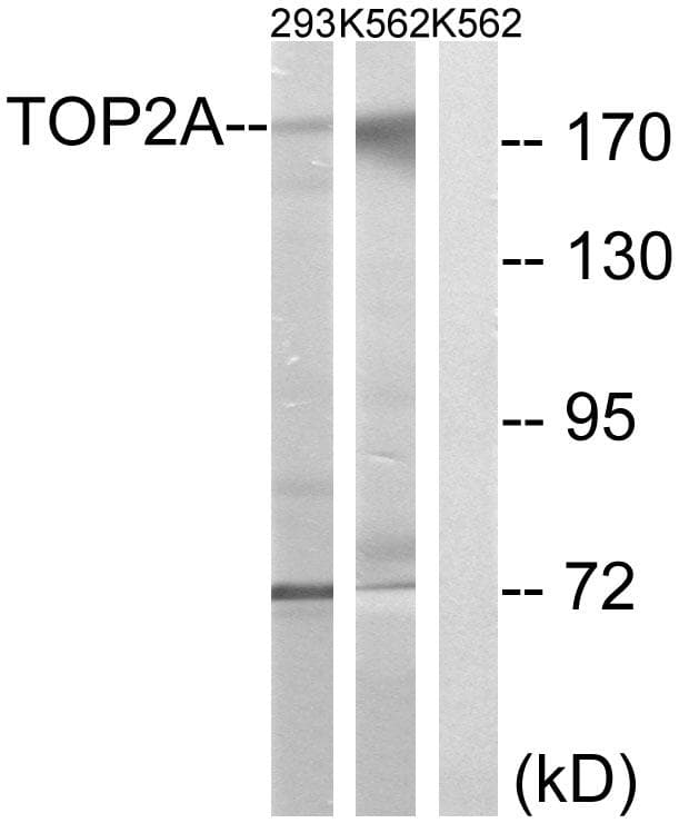 TOP2A / Topoisomerase II Alpha Antibody (p1525)