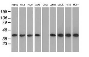 ACAT2 Antibody (clone OTI5F7)