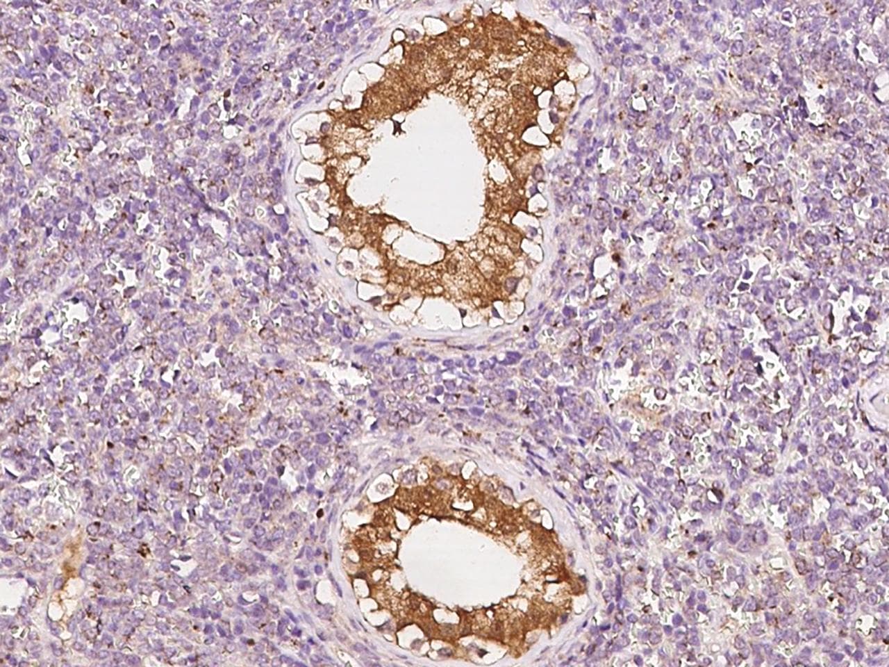 NUDT10 Antibody