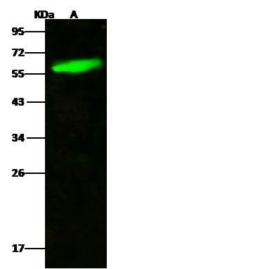 Polyclonal Rabbit anti-Human KLK1 / Kallikrein 1 Antibody (Preservative Free, WB)